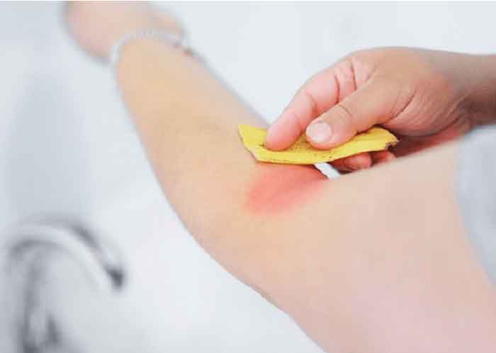 banana_peel_mosquito1