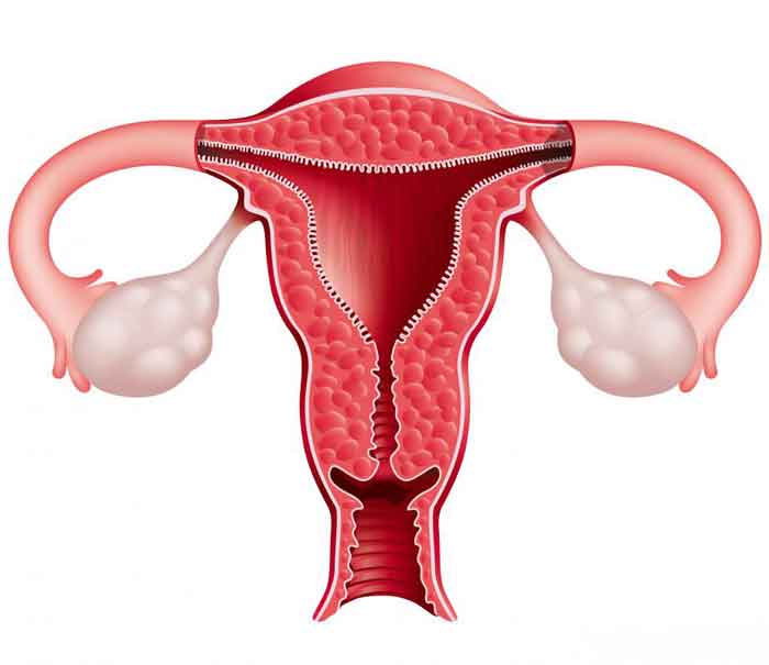 uterus_prblm_pic