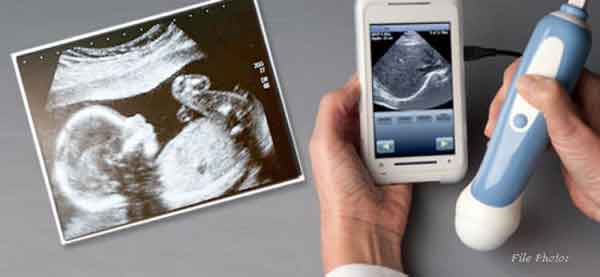 ultr_sound_baby
